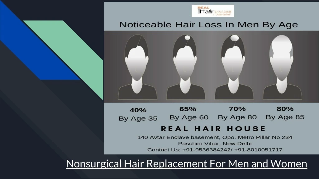 nonsurgical hair replacement for men and women