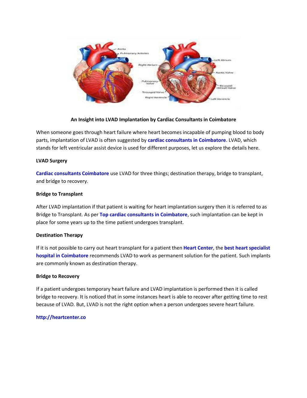 an insight into lvad implantation by cardiac
