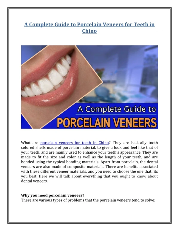 A Complete Guide to Porcelain Veneers for Teeth in Chino