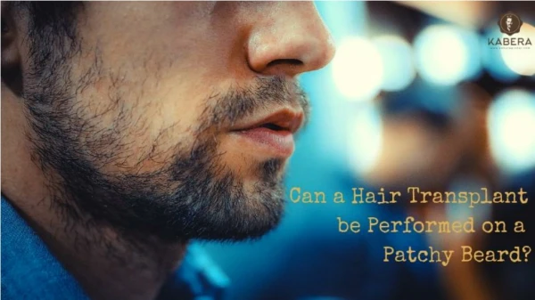 Can a Hair Transplant be Performed on a Patchy Beard?
