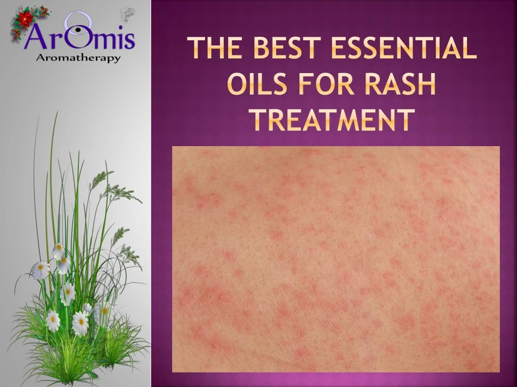 the best essential oils for rash treatment