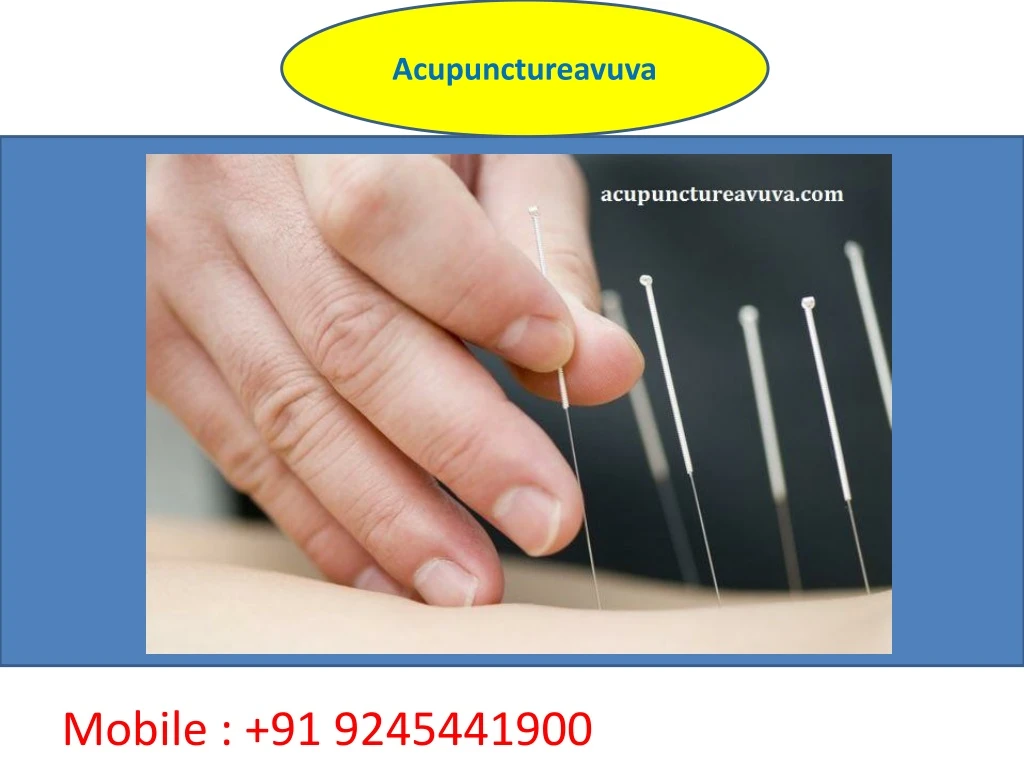 acupunctureavuva