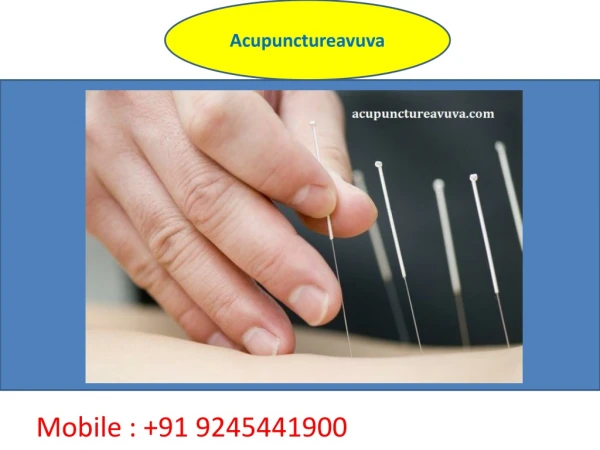 Best Acupuncture Treatment in Chennai