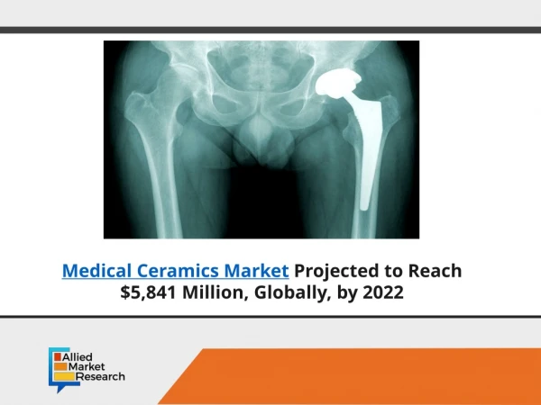 Medical ceramics market estimate to reach $5,841 Mn by 2022