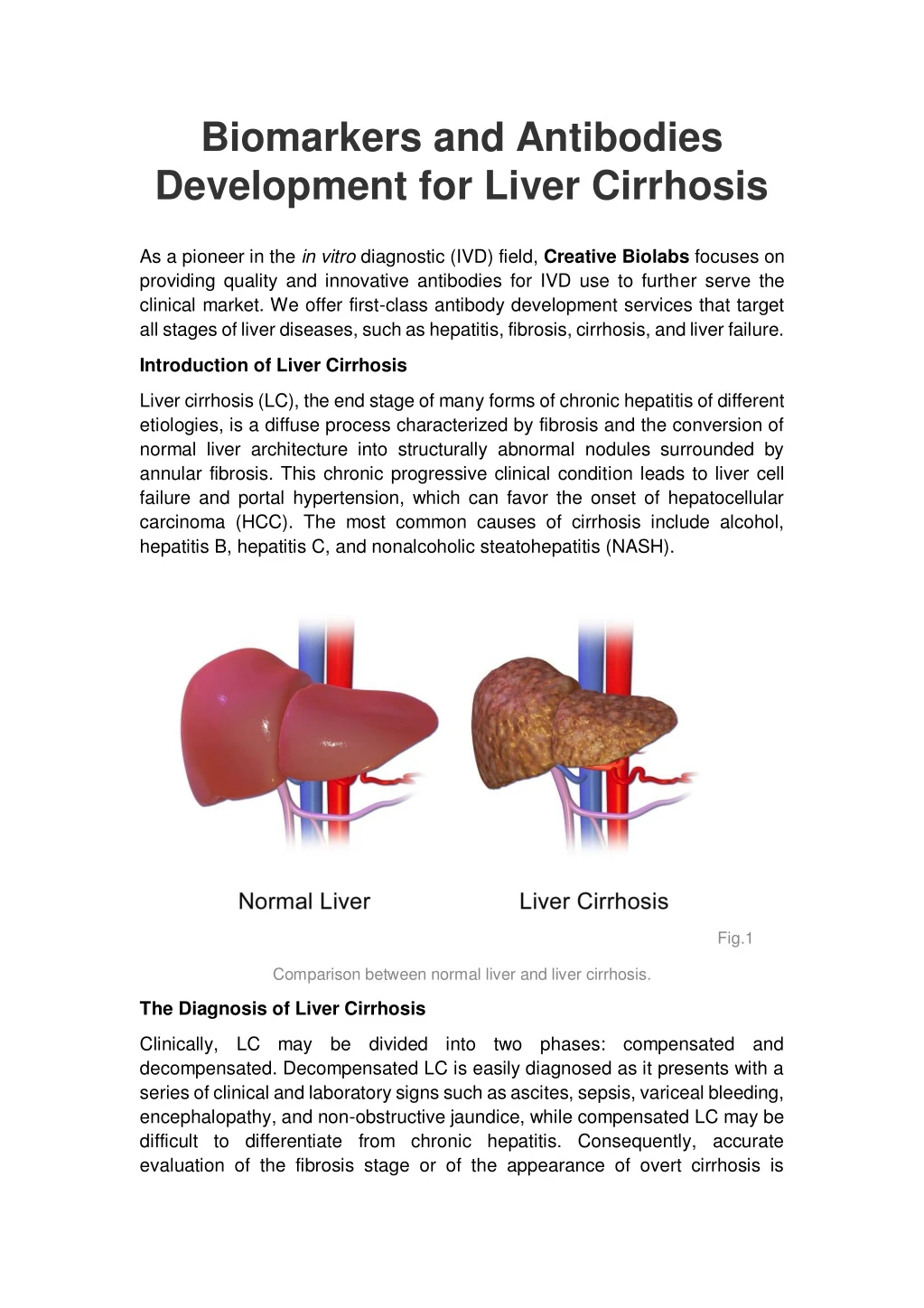 biomarkers and antibodies development for liver