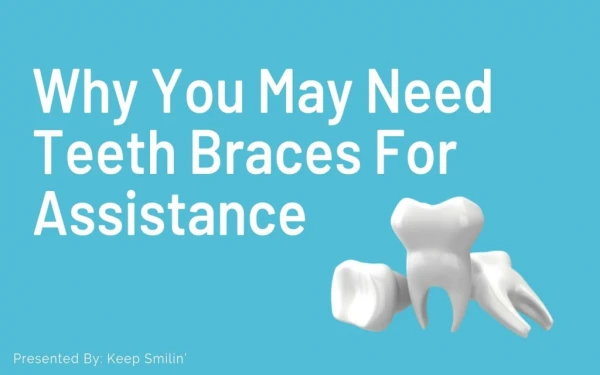 Why You May Need Teeth Braces For Assistance
