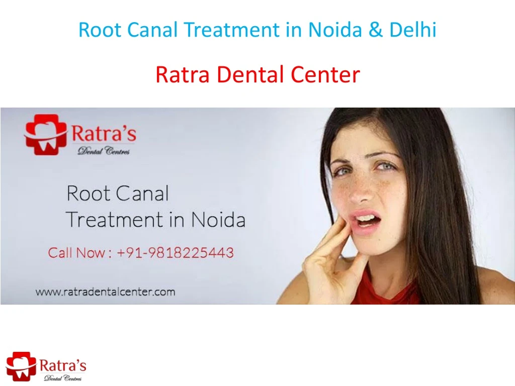 root canal treatment in noida delhi