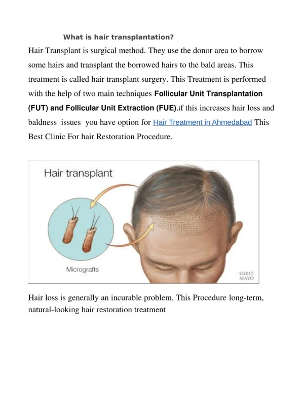 Get Permanent Solution For Your Hair Loss Treatment