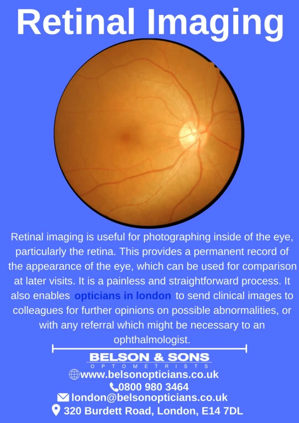 Retinal Imaging