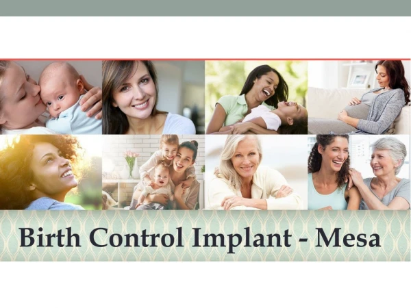 Birth Control Implant - Mesa