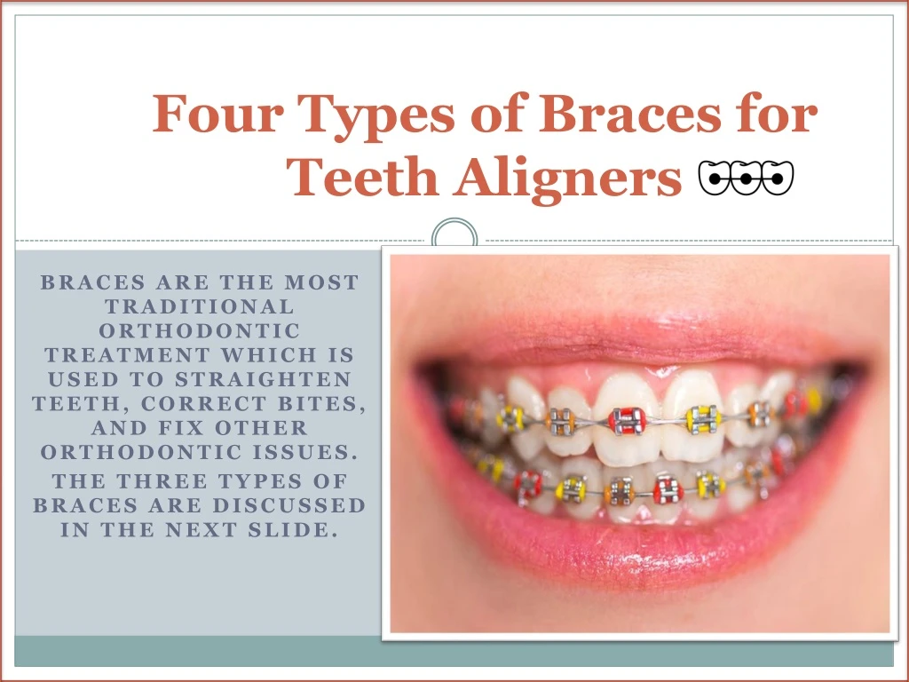 four types of braces for teeth aligners