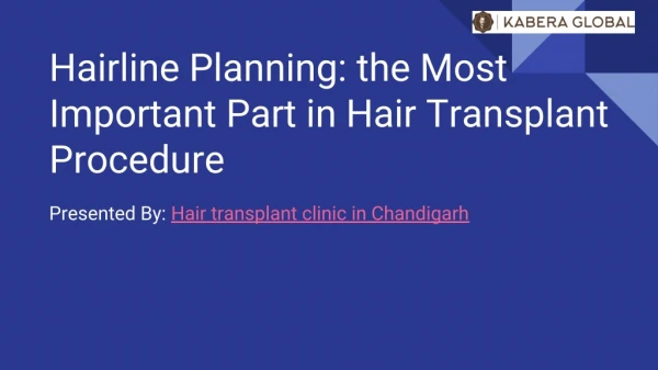Hairline Planning: the Most Important Part in Hair Transplant Procedure