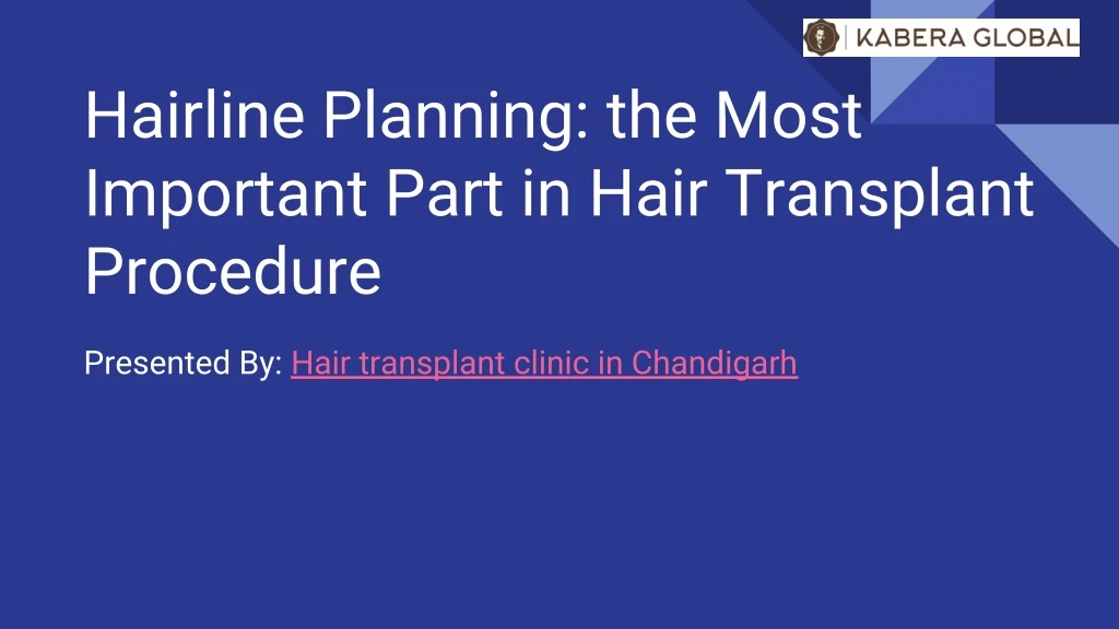 hairline planning the most important part in hair
