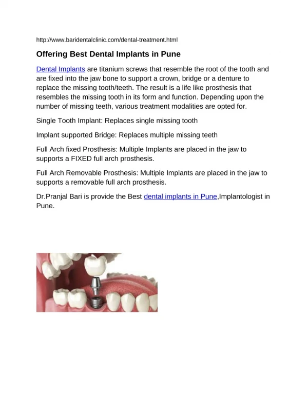 Offering Best Dental Implants in Pune