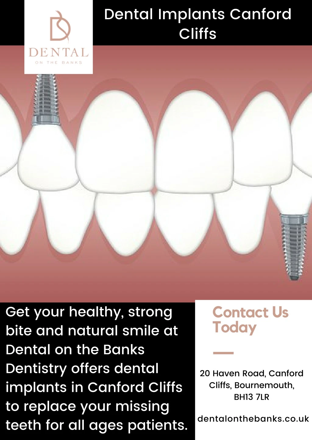 dental implants canford cliffs