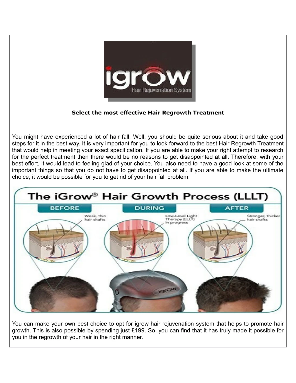 select the most effective hair regrowth treatment