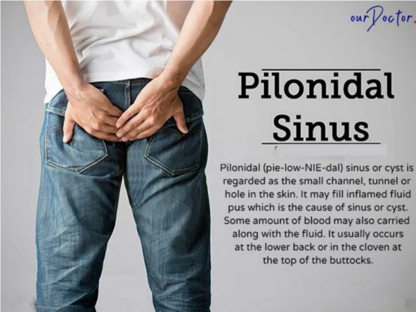 Pilonidal Sinus