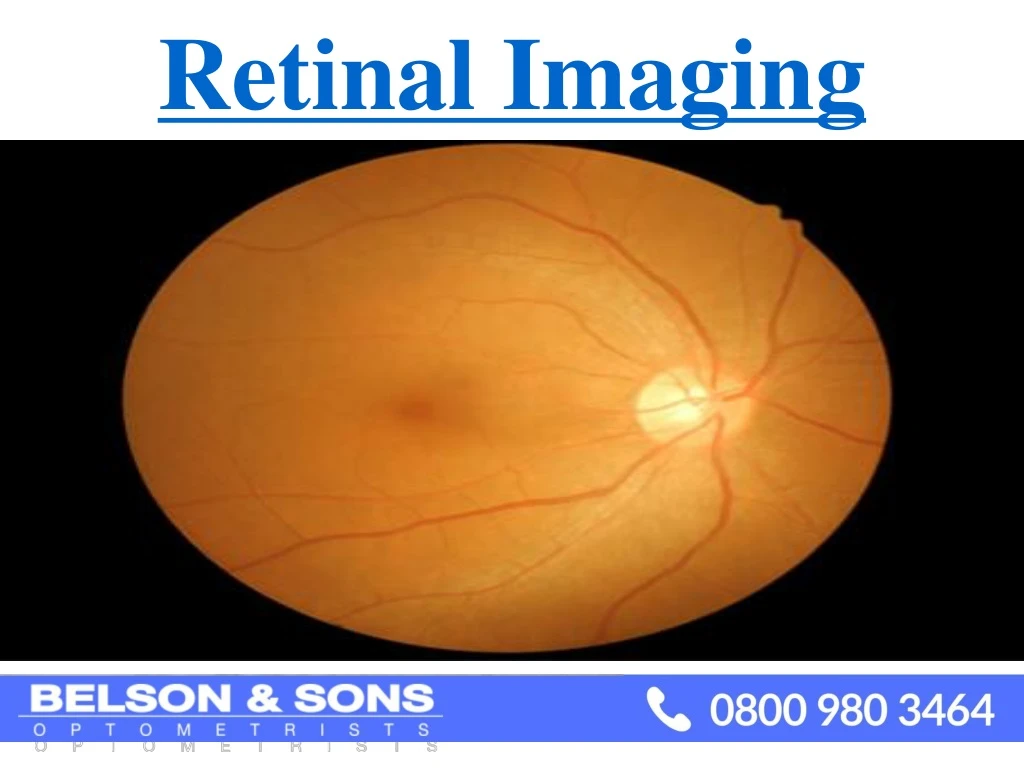 retinal imaging