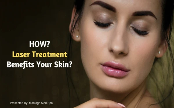 How Laser Treatment Benefits Your Skin