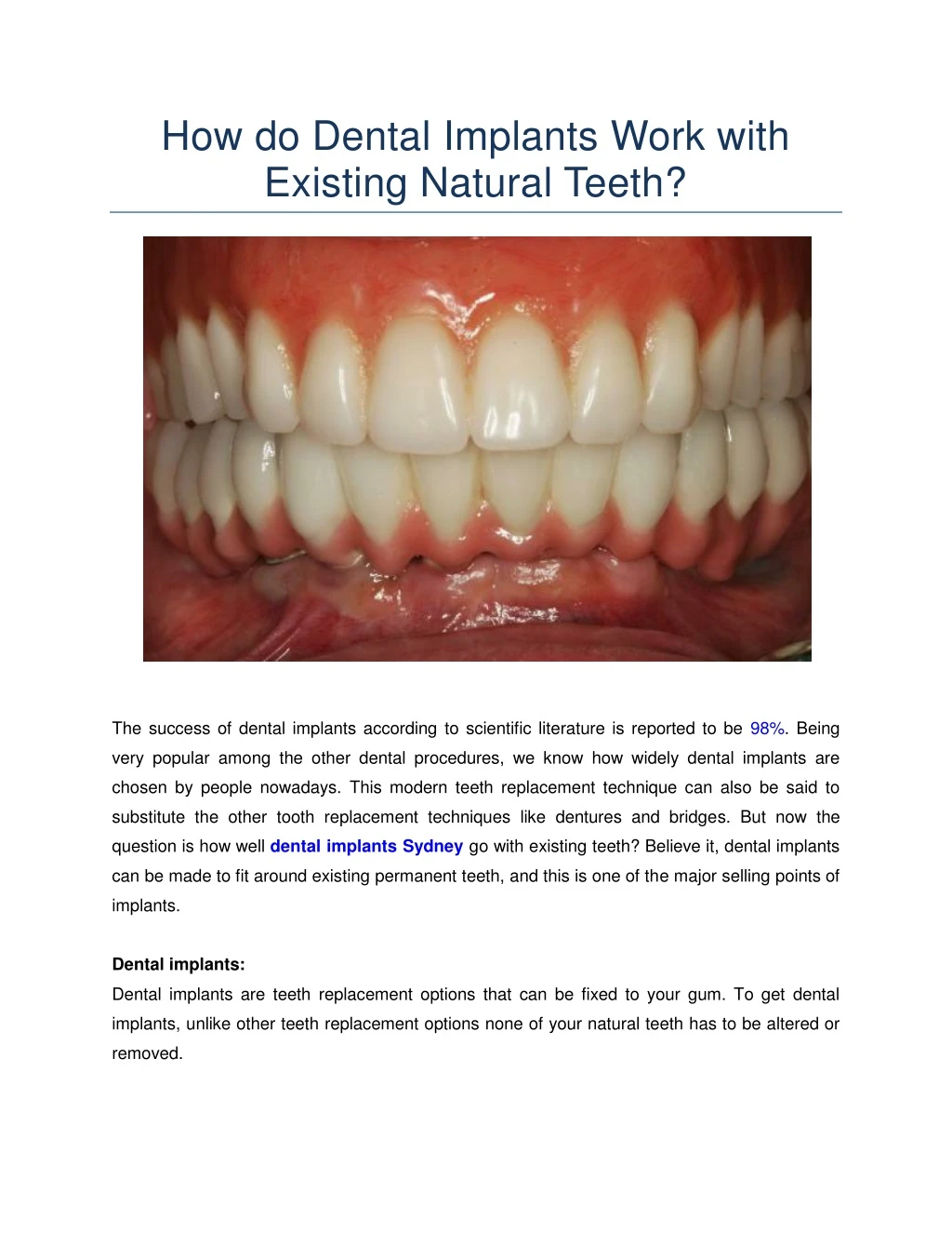 how do dental implants work with existing natural