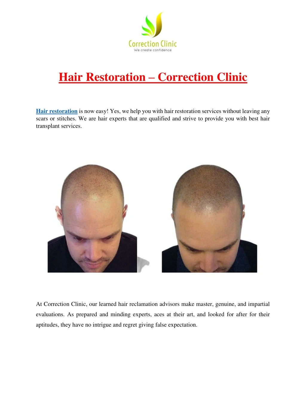 hair restoration correction clinic