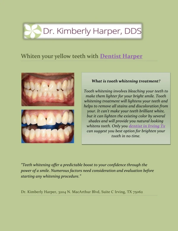 Whiten your yellow teeth with Dentist Harper!