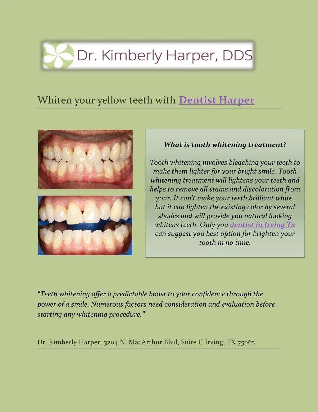 whiten your yellow teeth with dentist harper