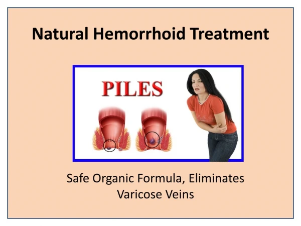 Pilepsole Capsule Helps With Hemorrhoid Flare-Ups