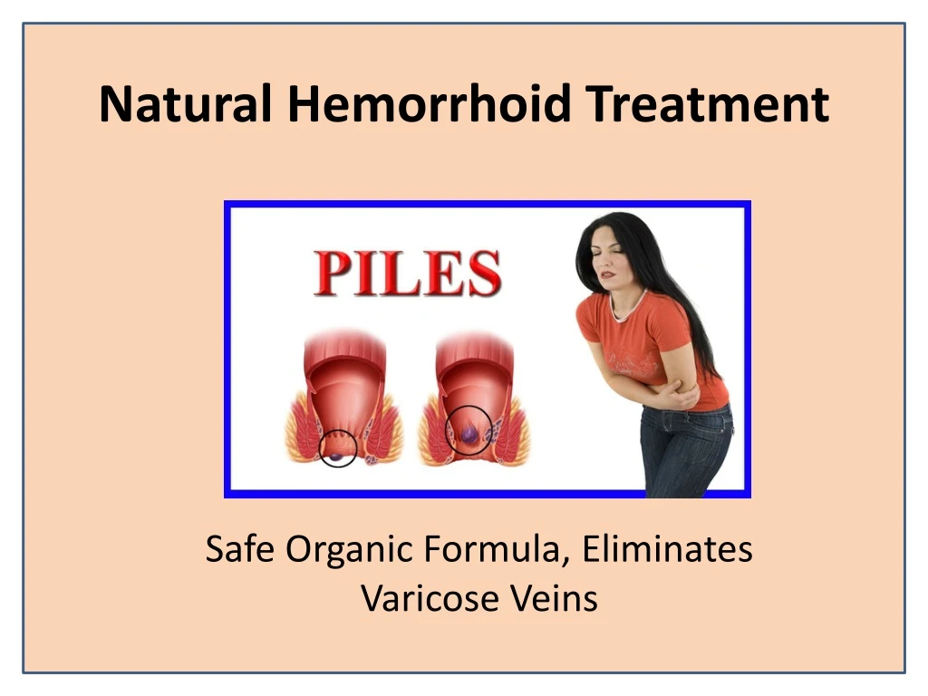 natural hemorrhoid treatment