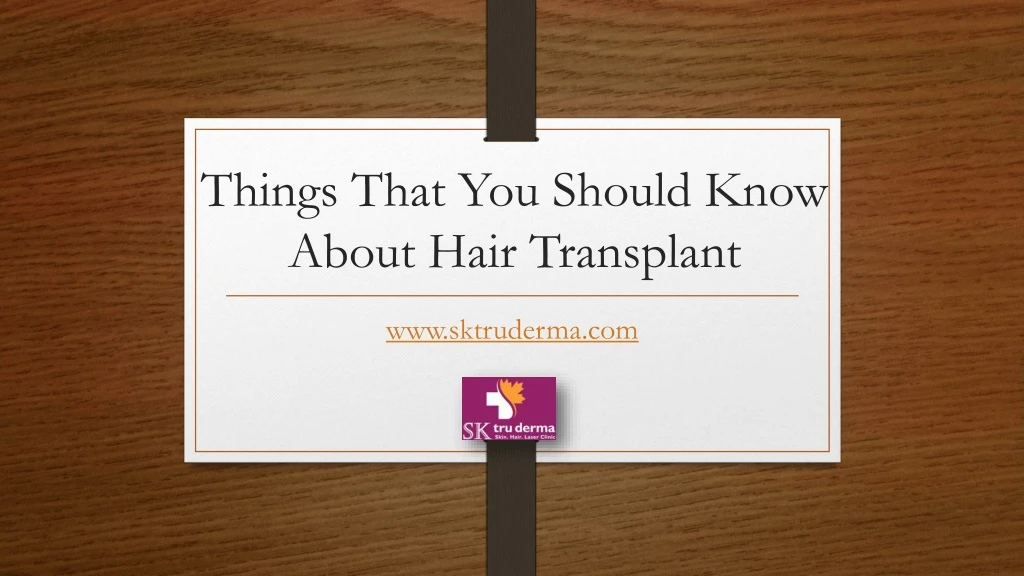 things that you should know about hair transplant