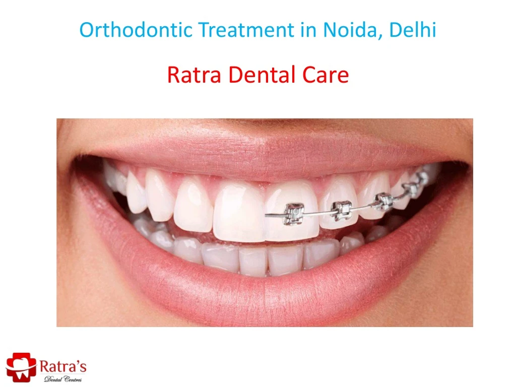 orthodontic treatment in noida delhi