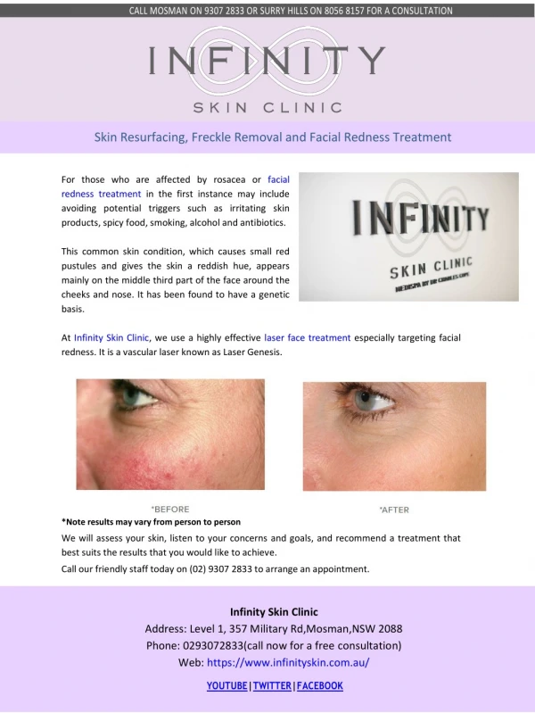 Skin Resurfacing, Freckle Removal and Facial Redness Treatment