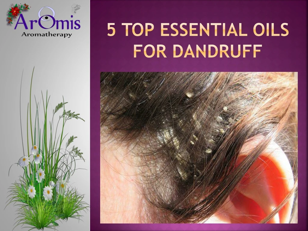 5 top essential oils for dandruff