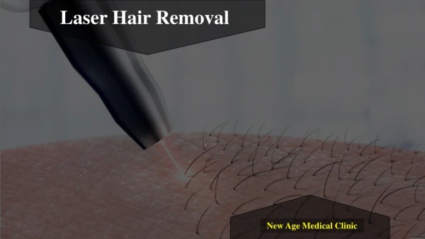 4 Reason to Choose Laser Hair Removal