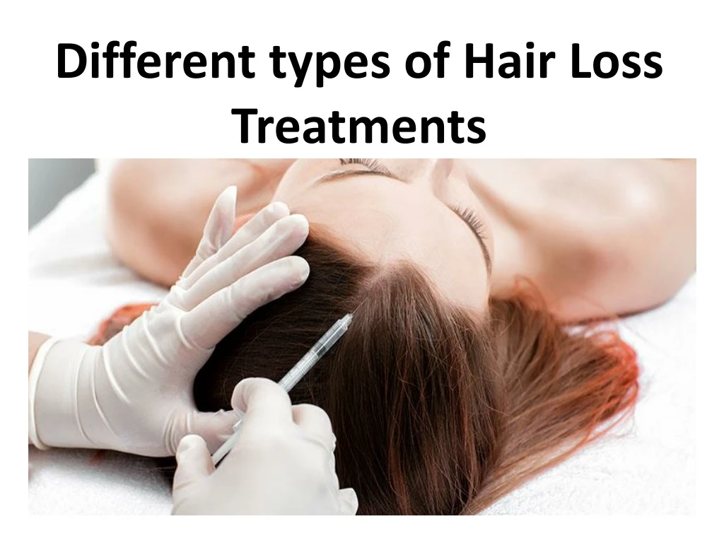 different types of hair loss treatments