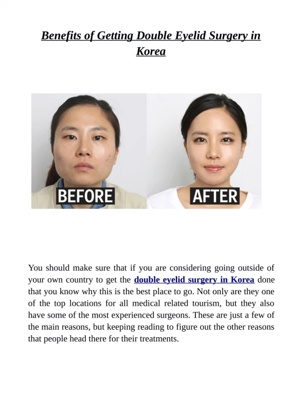 Benefits of Getting Double Eyelid Surgery in Korea