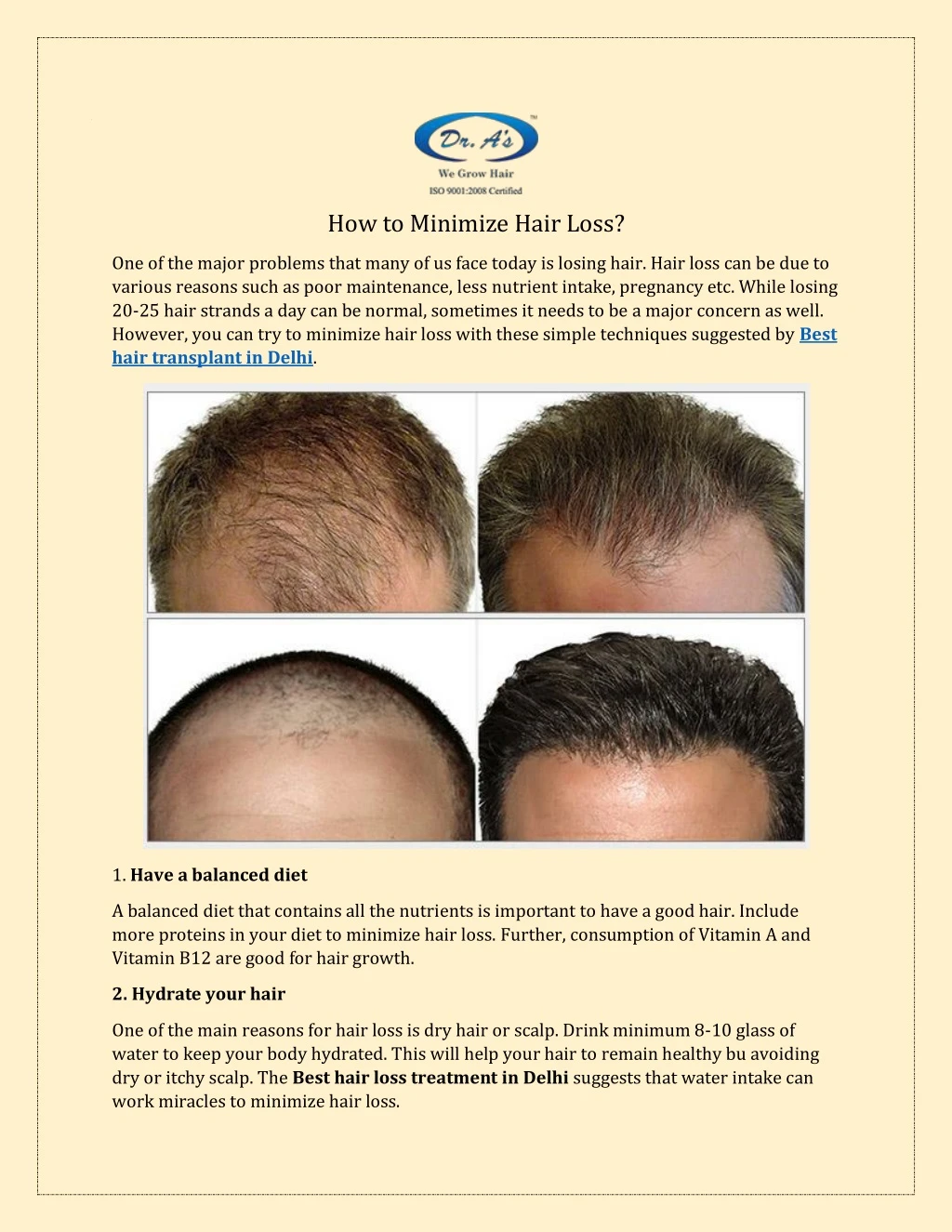 how to minimize hair loss