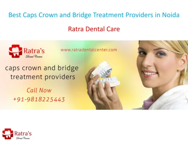 Best Caps Crown and Bridge Treatment Providers in Noida