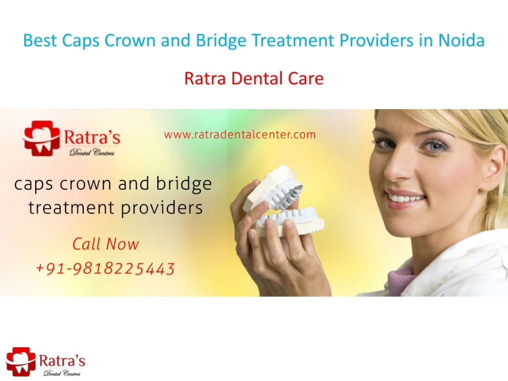 best caps crown and bridge treatment providers