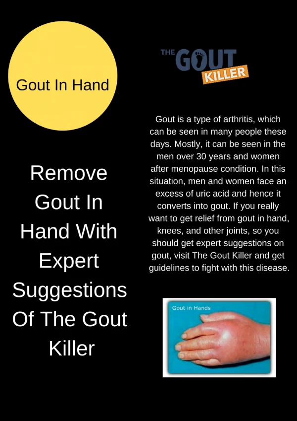Remove Gout In Hand With Expert Suggestions Of The Gout Killer