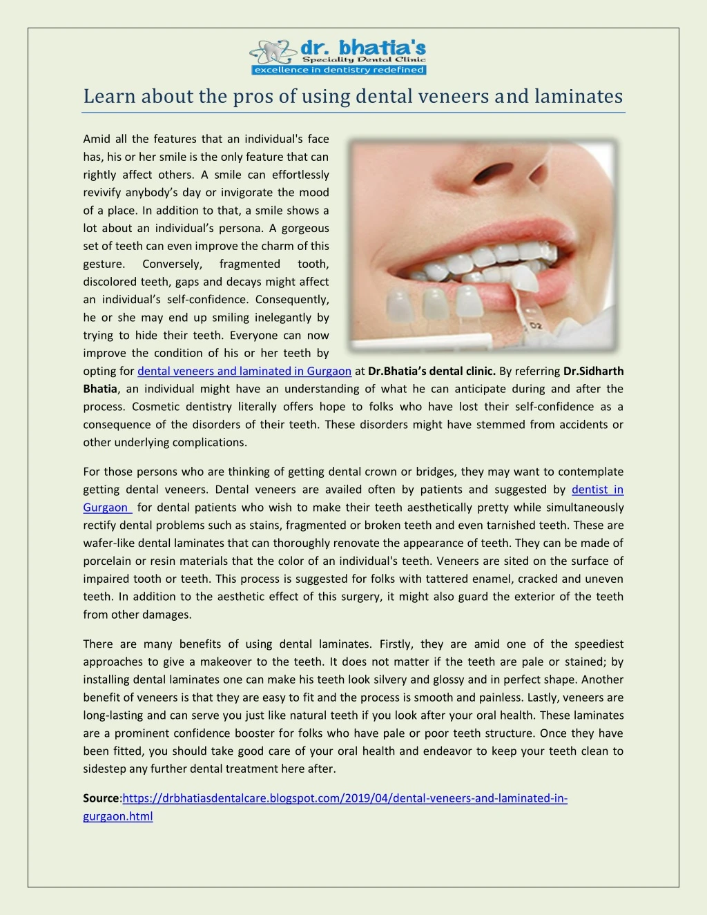 learn about the pros of using dental veneers