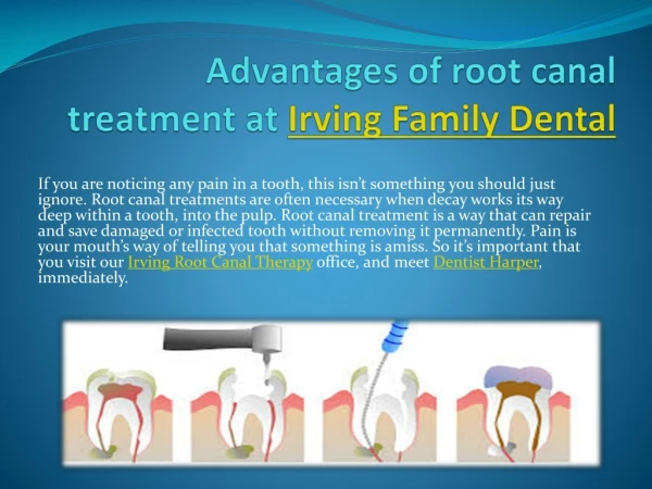 Advantages of root canal treatment at Irving Family Dental.