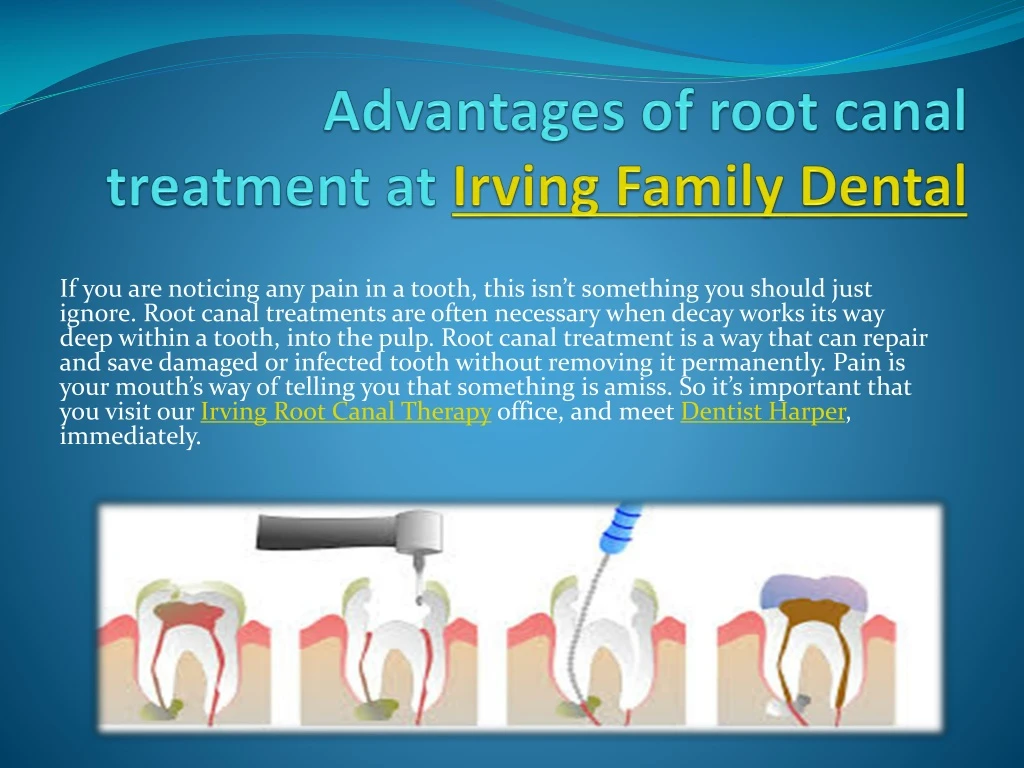 advantages of root canal treatment at irving family dental