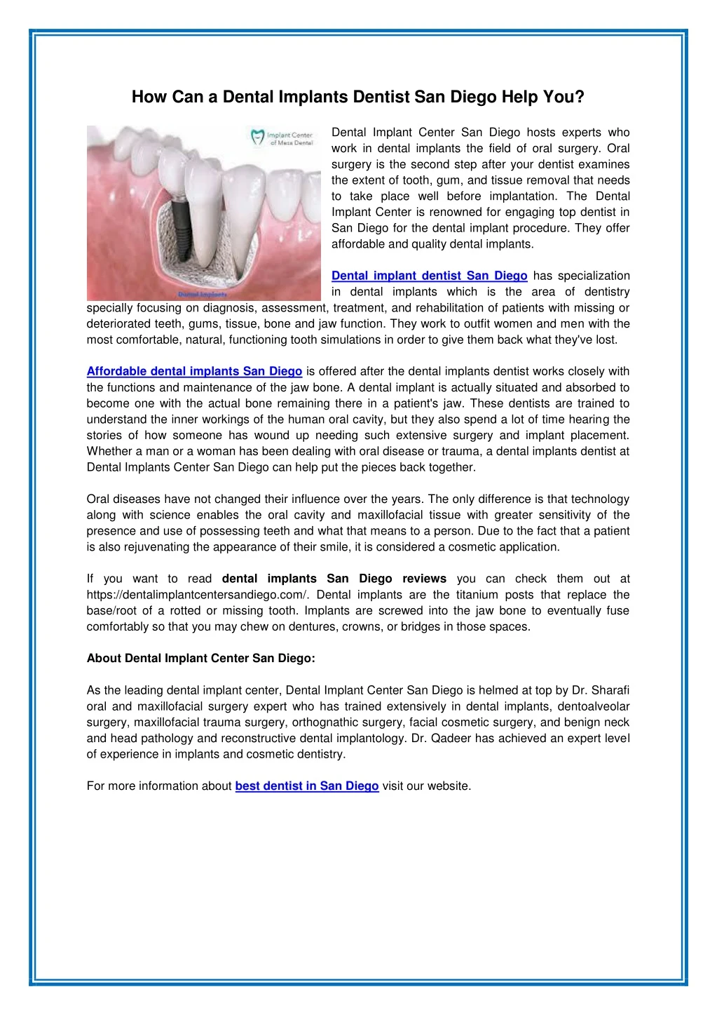 how can a dental implants dentist san diego help
