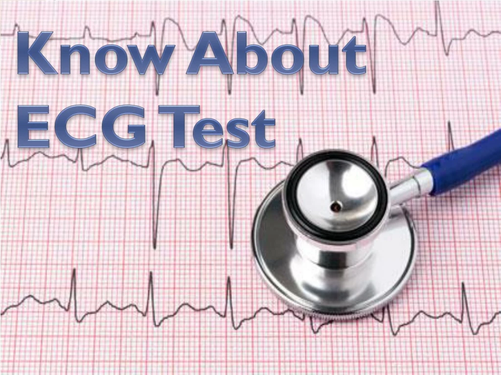 know about ecg test