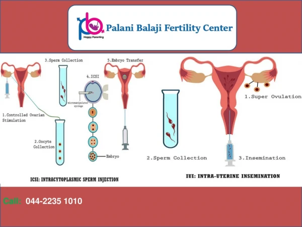 Good Fertility Doctor In Chennai