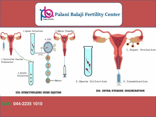 Best Infertility Treatment in Chennai