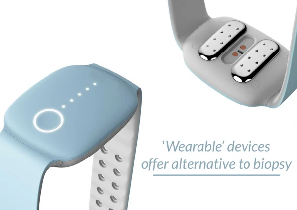 Wearable Devices Offer Alternative To Biopsy Techugo