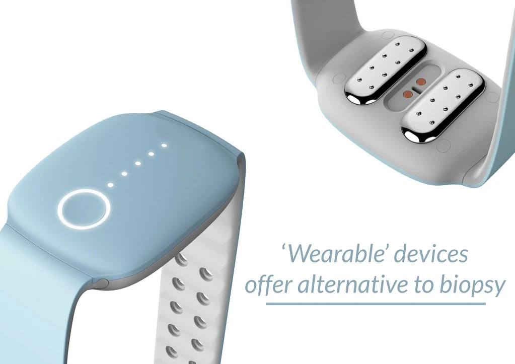 wearable devices offer alternative to biopsy