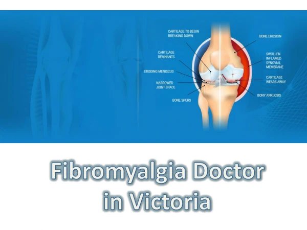 Fibromyalgia Doctor in Victoria